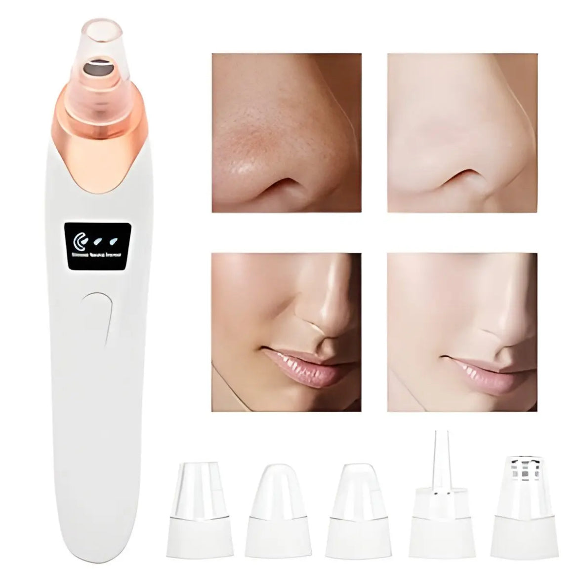 Black head Remover - 5 in 1
Rechargeable Blackhead Remover - Acne Remover
- Vacuum Suction - Face Pore Cleaner - Facial
Beauty Equipment - Blackhead Removal Machine - LED Display